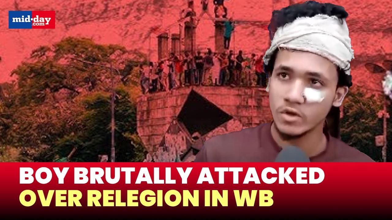 West Bengal boy attacked in Bangladesh over religion, gets severely injured